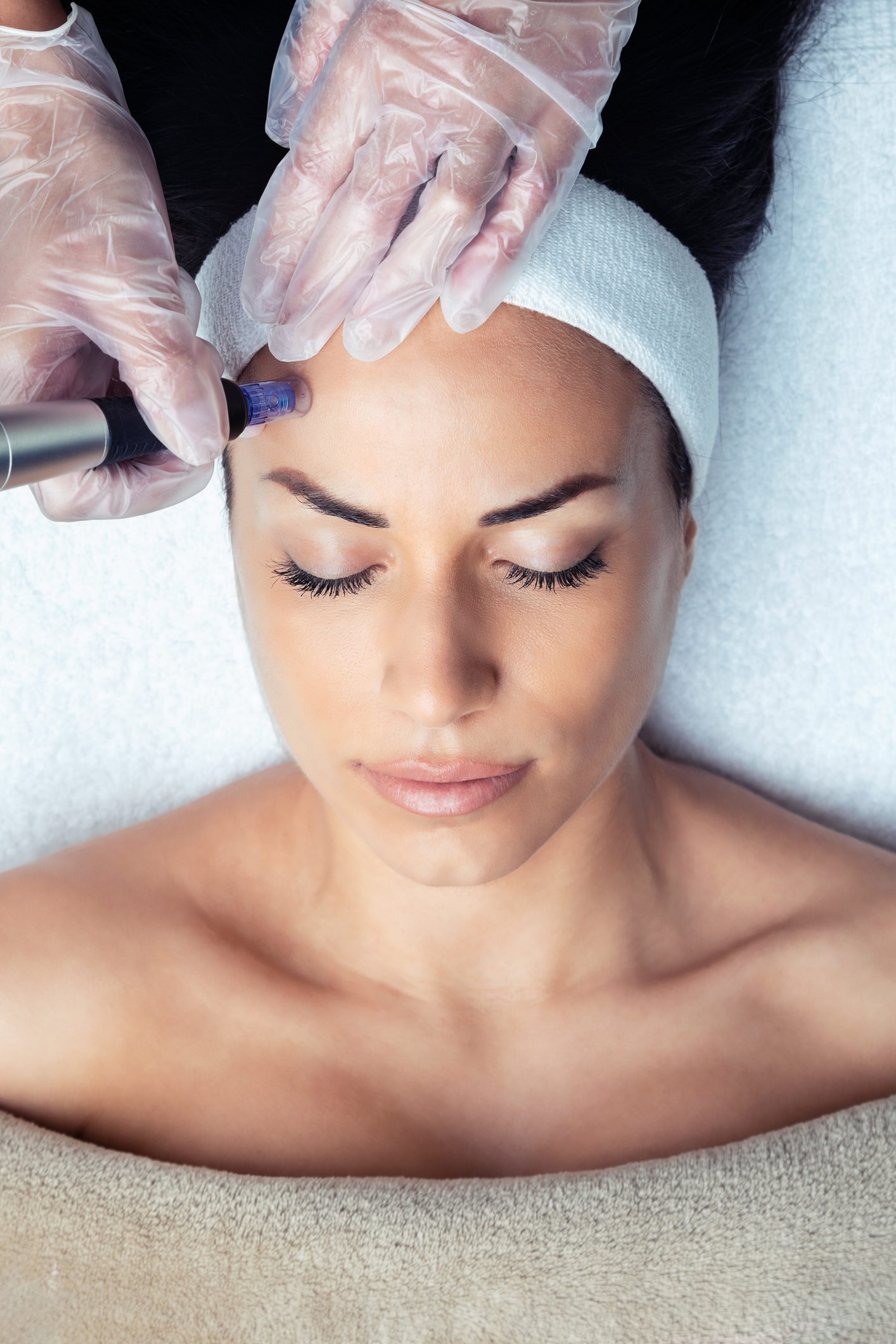 microchannel facial